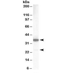 Anti-MCL1