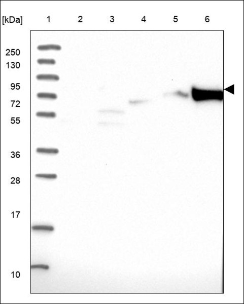 Anti-FHIP1B