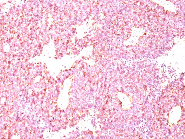 Anti-Chromogranin A / CHGA (Neuroendocrine Marker), clone LK2H10 + PHE5