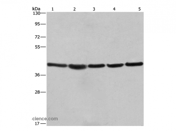 Anti-RPSA