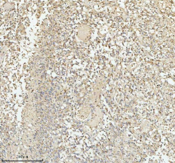 Anti-PACSIN1 / Protein kinase C and casein kinase substrate in neurons protein 1
