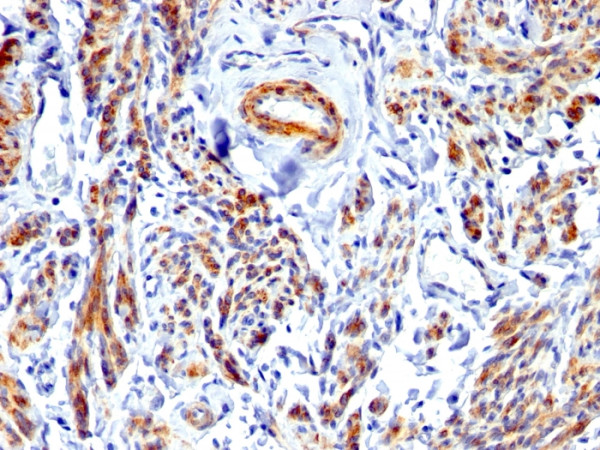 Anti-Caldesmon, HMW (h-Caldesmon) (Smooth Muscle Marker)