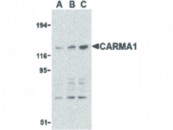 Anti-CARMA1