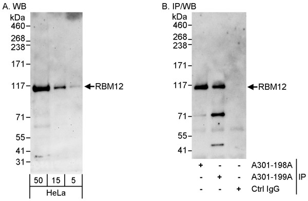 Anti-RBM12