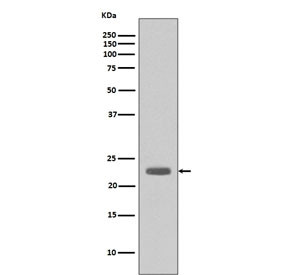 Anti-Bim / BCL2L11, clone CBE-2