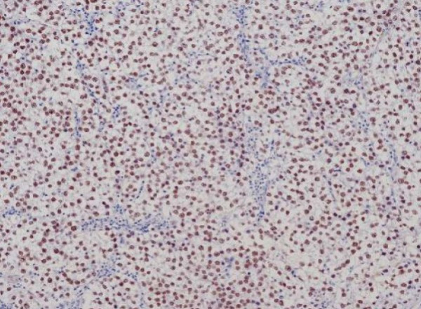 Anti-Sall4, clone SQab22262