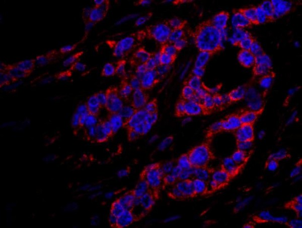 Anti-DOCK4 (IHC)
