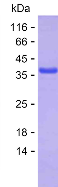 MDM2 (human), recombinant protein