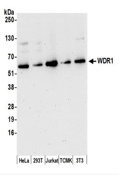 Anti-WDR1