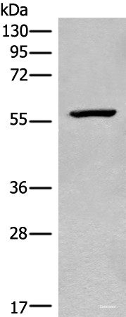 Anti-CDADC1