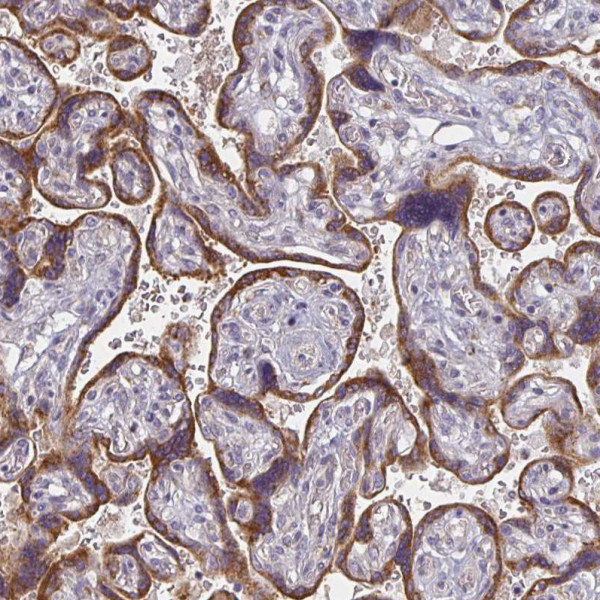 Anti-CTHRC1
