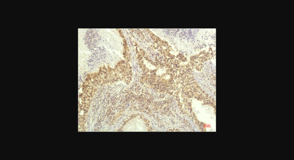 Anti-P70 S6 Kinase (1C7), monoclonal