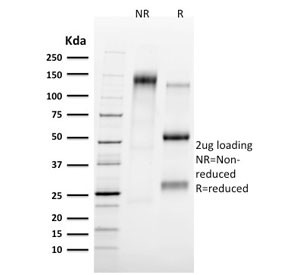 Anti-TAL1 / T-cell acute lymphocytic leukemia protein 1, clone TAL1/2707