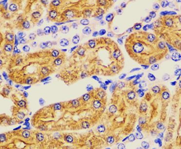 Anti-ALDH2