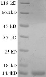 Prostate stem cell antigen (PSCA), partial, human, recombinant