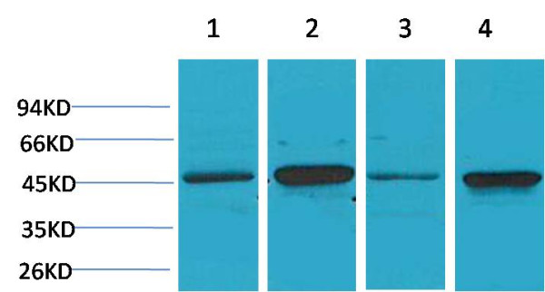 Anti-GSK 3beta