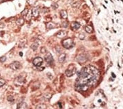 Anti-Recoverin
