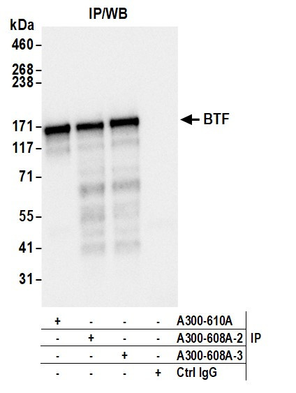 Anti-BTF