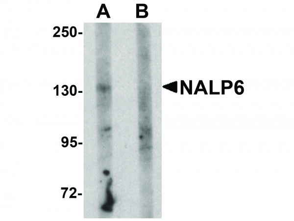 Anti-NALP6