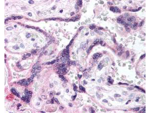 Anti-phospho-EGF-Receptor (Tyr1197) (erbB, EGFR, Epidermal Growth Factor Receptor)