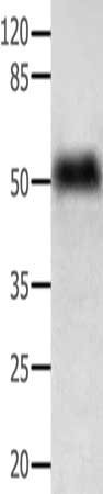 Anti-ACTG1