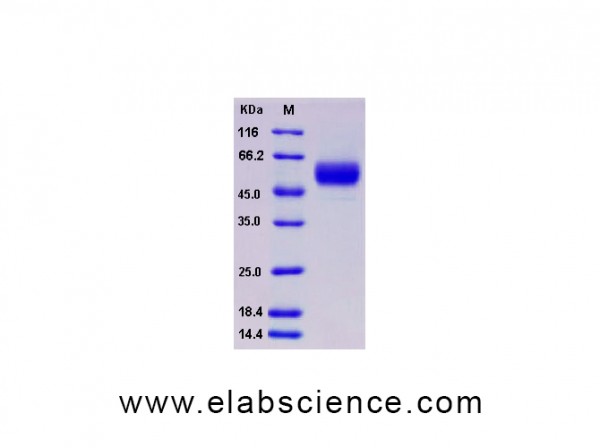 Recombinant Human Vaspin / SerpinA12 Protein (His tag)