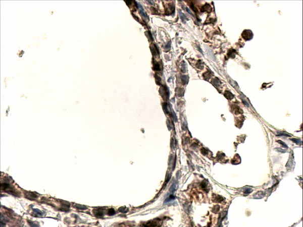 Anti-Dual oxidase 1, Internal
