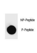 Anti-phospho-PARP1 (Thr368)