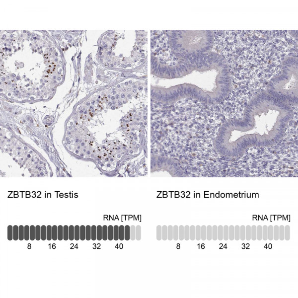 Anti-ZBTB32