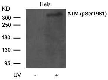 Anti-phospho-ATM (Ser1981)