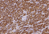 Anti-Carboxypeptidase A1/CPA1 Monoclonal Antibody