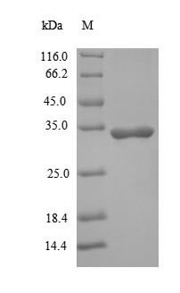 Interleukin-1 beta (IL1B), human, recombinant