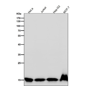 Anti-Histone H3 (di methyl K4) / HIST1H3A, clone 31H99