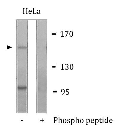 Anti-phospho-MST1R / RON (Ser1394)