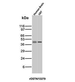 Anti-SPARC / Osteonectin, clone r15G12