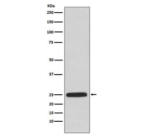 Anti-HPRT, clone ADAB-8