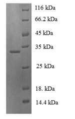 Neuroglobin (NGB), human, recombinant