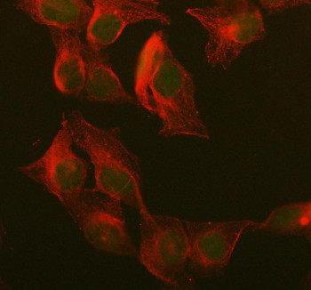 Anti-UCHL3, clone 26U65