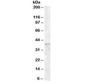 Anti-DKK1