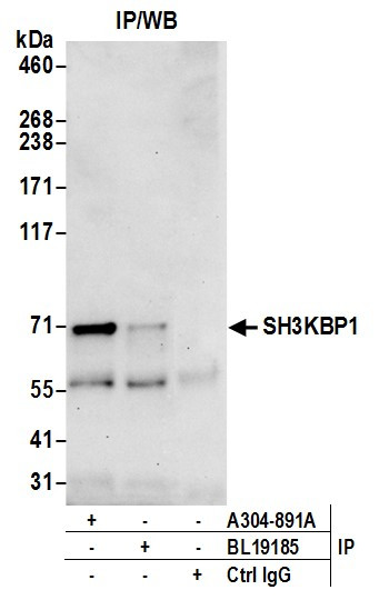 Anti-SH3KBP1 Binding Protein 1/SHKBP1