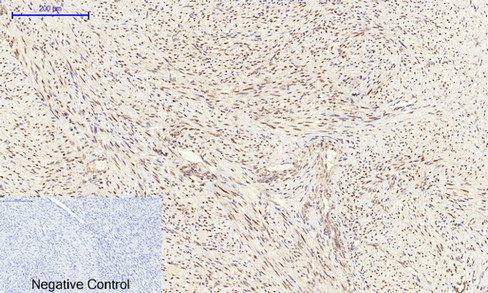 Anti-CEBP Beta