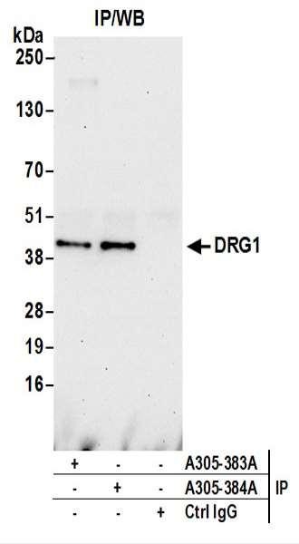 Anti-DRG1