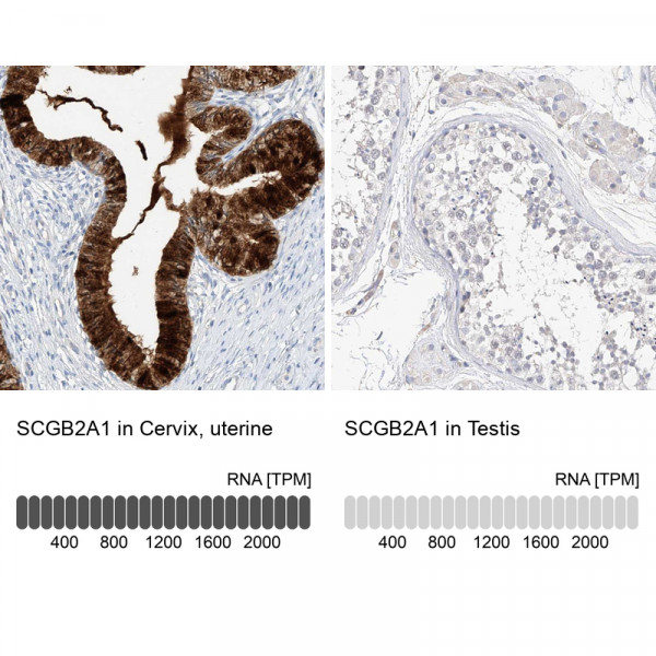 Anti-SCGB2A1