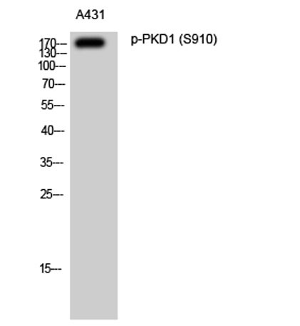 Anti-phospho-PKD1 (Ser910)