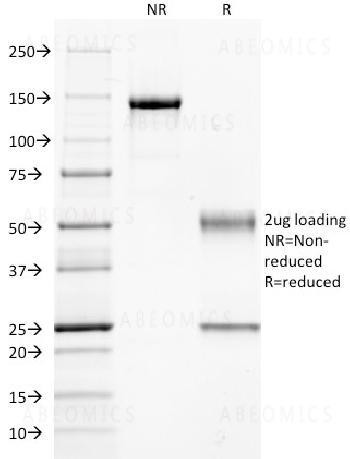 Anti-Guanine nucleotide-binding protein alpha-q / GNAQ / G-ALPHA-q Monoclonal Antibody (Clone: GNAQ/