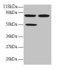 Anti-CCL22