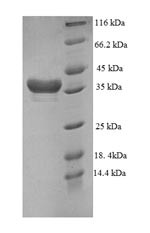 DTW domain-containing protein 1 (DTWD1), partial, human, recombinant