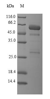 Galectin-8 (LGALS8) (Active), human, recombinant