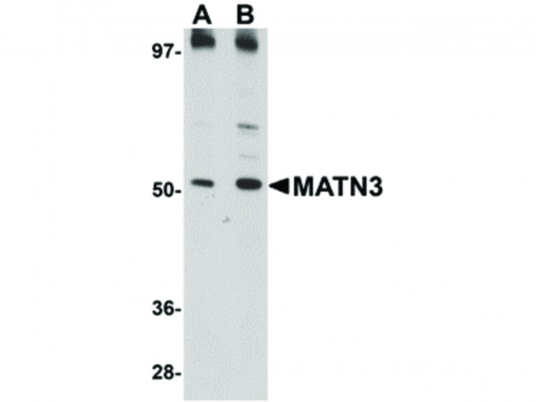 Anti-MATN3