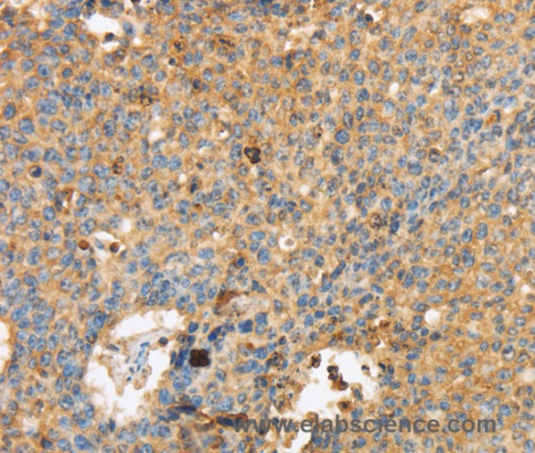 Anti-MAPK6